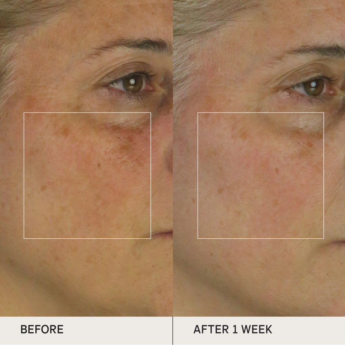BrighteningSerum-Aug26-Ppage-Clinicals.jpg
